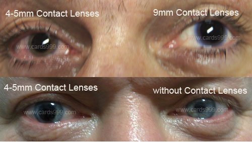 Infrared Contact Lenses