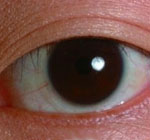 X ray contact lenses